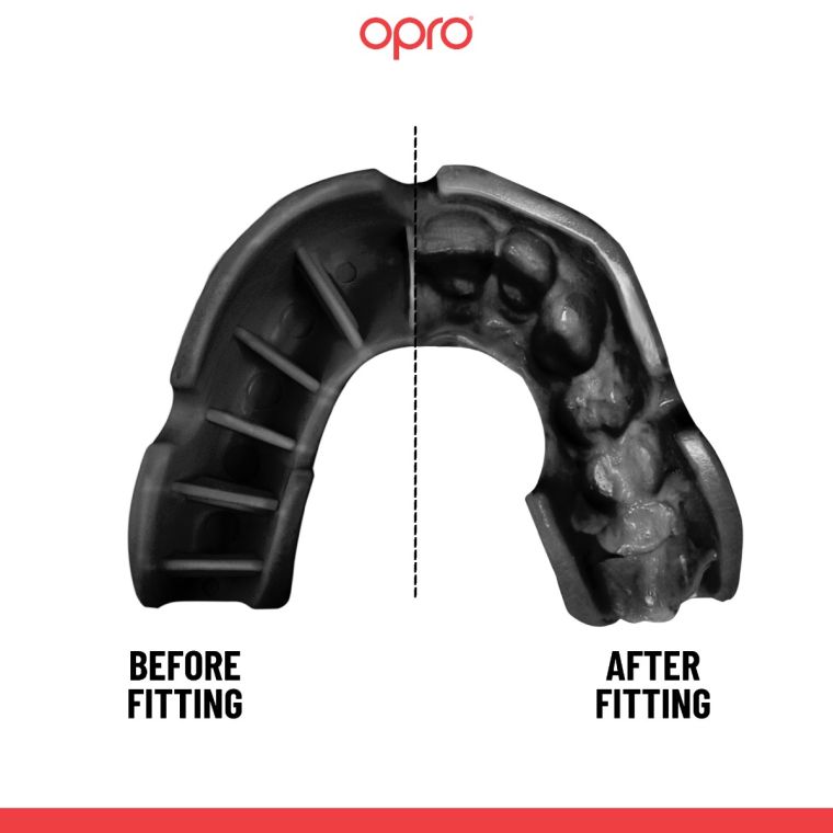 OPRO Self-Fit Bronze